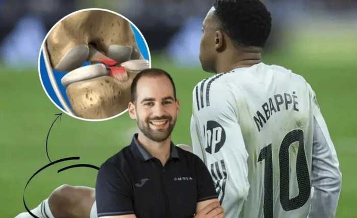 姆巴佩左膝伤情恐恶化，专家警告或致韧带断裂